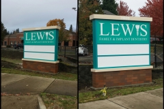 Lewis Family & Implant Dentistry – Vancouver, WA